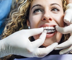 A dentist helping a patient with a clear aligner.
