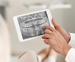 Digital x-rays on tablet computer