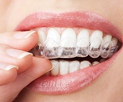 Patient placing Invisalign tray