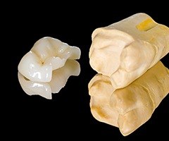 Model tooth with onlay restoration