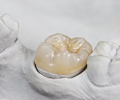 Model smile with dental crown