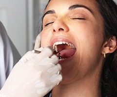 Woman receiving oral cancer screening